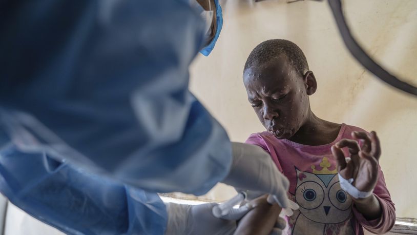 FILE - A health worker attends to a mpox patient, at a treatment centre in Munigi, eastern Congo, Aug. 19, 2024. (AP Photo/Moses Sawasawa, File)