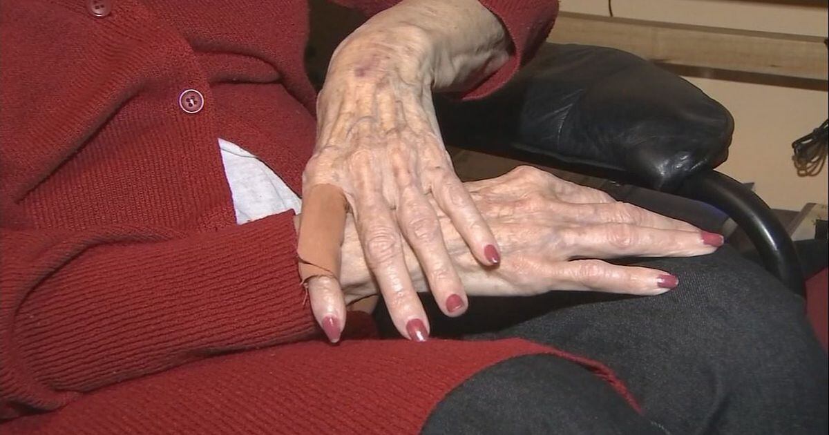 He Turned Around And Bopped Me 93 Year Old Florida Woman Left Beaten After Carjacking 3558