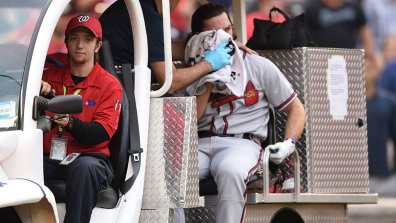 Medical staff takes the Braves' Charlie Culberson off the field after he was hit by a pitch in the seventh inning Saturday against the Nationals.