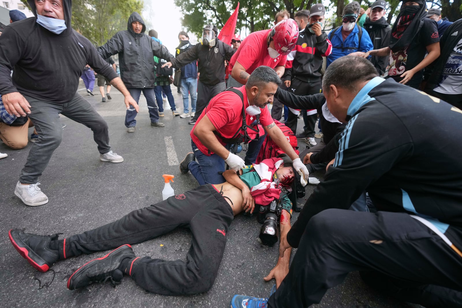 Medics tend to a photographer injured during clashes that broke out as soccer fans joined retirees demanding higher pensions and opposing austerity measures implemented by Javier Milei's government in Buenos AIres, Argentina, Wednesday, March 12, 2025. (AP Photo/Rodrigo Abd)