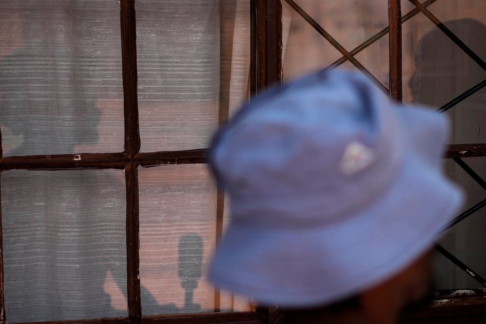 A miner, who spoke on condition of anonymity out of fear of reprisals, shows bruises on his hands that he got while climbing out of the mine, during an interview with The Associated Press, in Stilfontein, South Africa, Wednesday, Jan. 15, 2025. (AP Photo/Themba Hadebe)