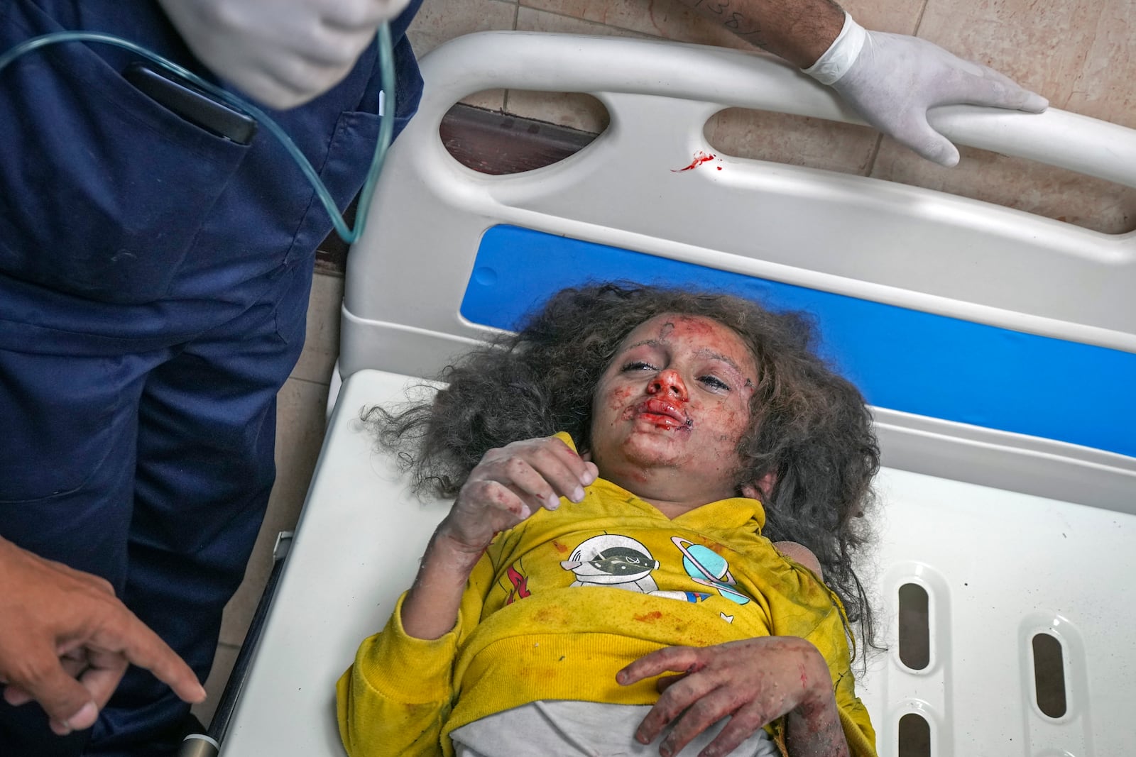 A girl injured during an overnight Israeli army strike is assisted upon her arrival at the hospital in Deir al-Balah, Gaza Strip, Sunday Nov. 24, 2024. (AP Photo/Abdel Kareem Hana)