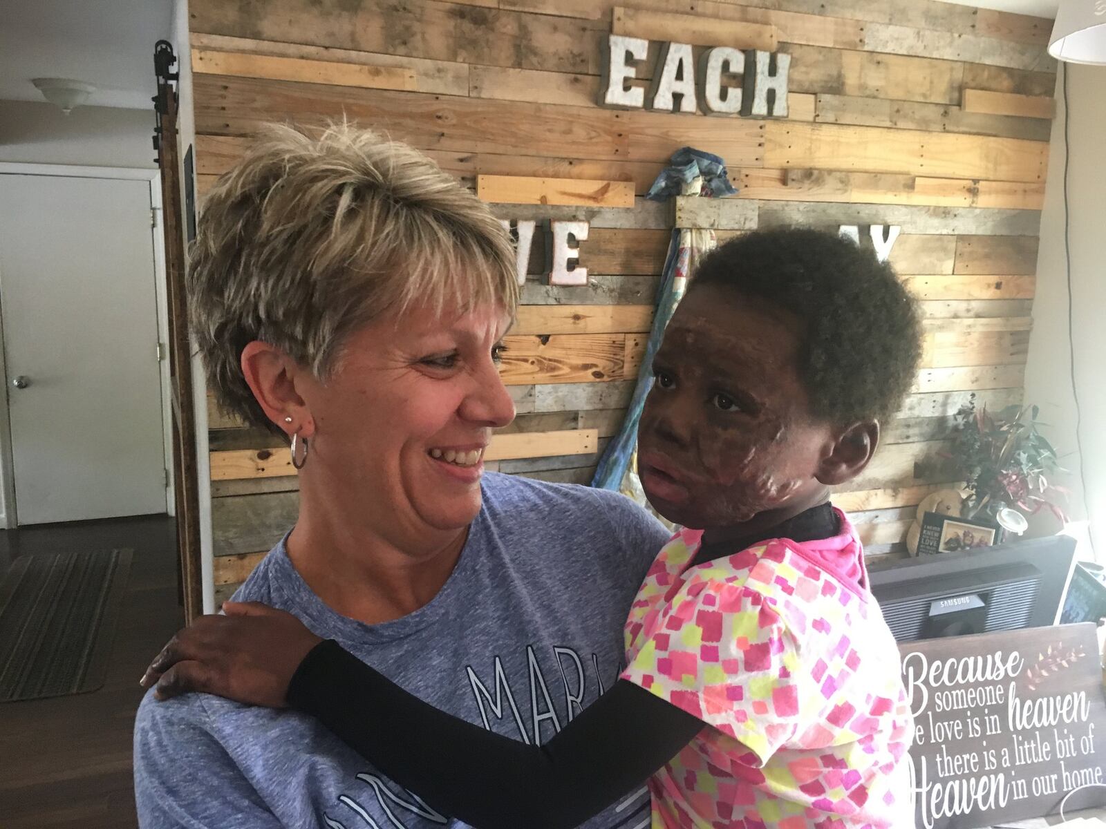 Bob and Margie Keseday, of Springboro, are caring for Rayagnewende “Anne” Bamogo, who was severely burned in an accidental fire in her homeland of Burkina Faso, a landlocked country in West Africa. RICK McCRABB/STAFF