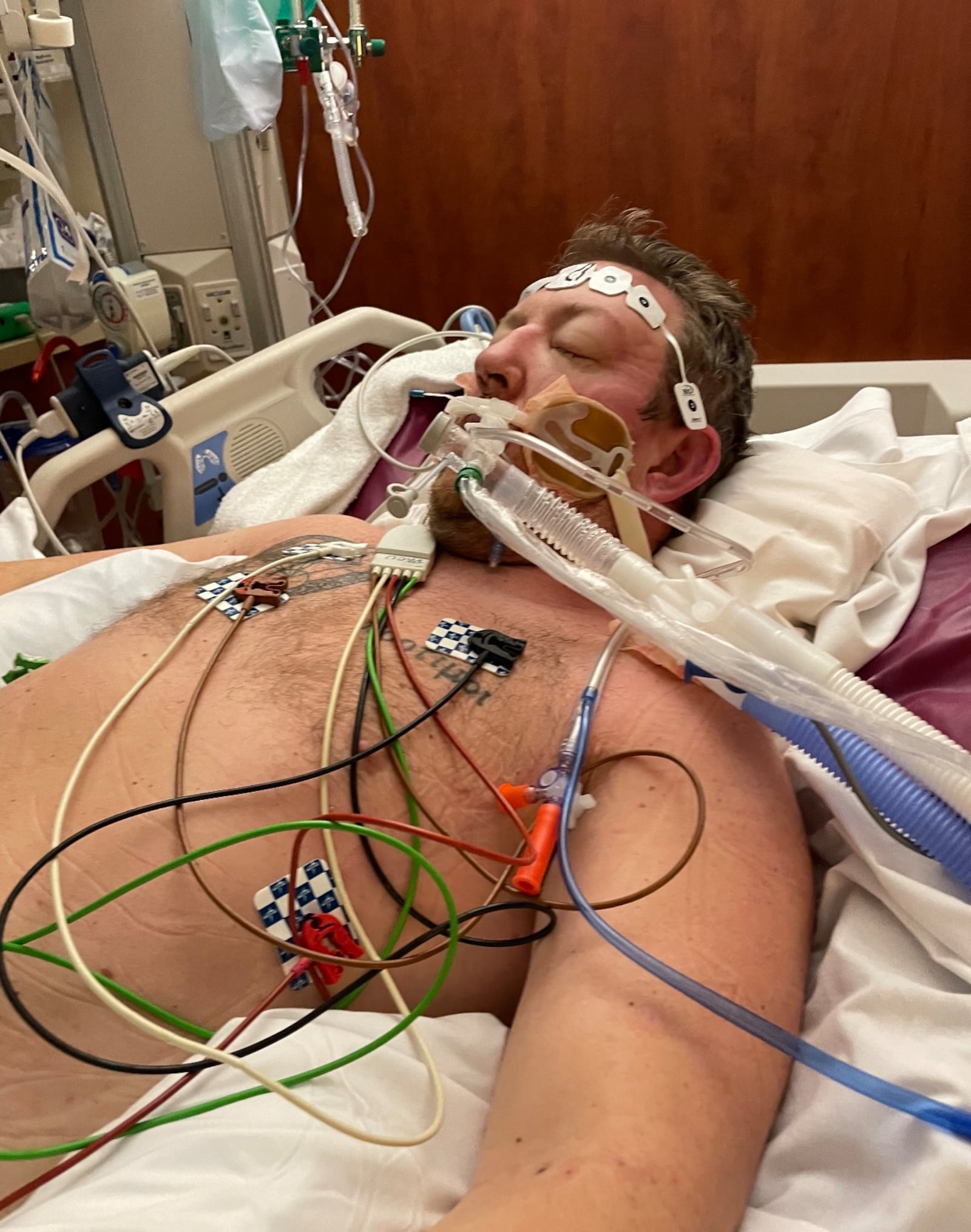 Matt Kemp, of West Chester Twp., was intubated during his long battle with COVID-19. He was treated at University of Cincinnati West Chester and the Ohio State University’s Ross Heart Hospital’s Intensive Care Unit. CONTRIBUTED