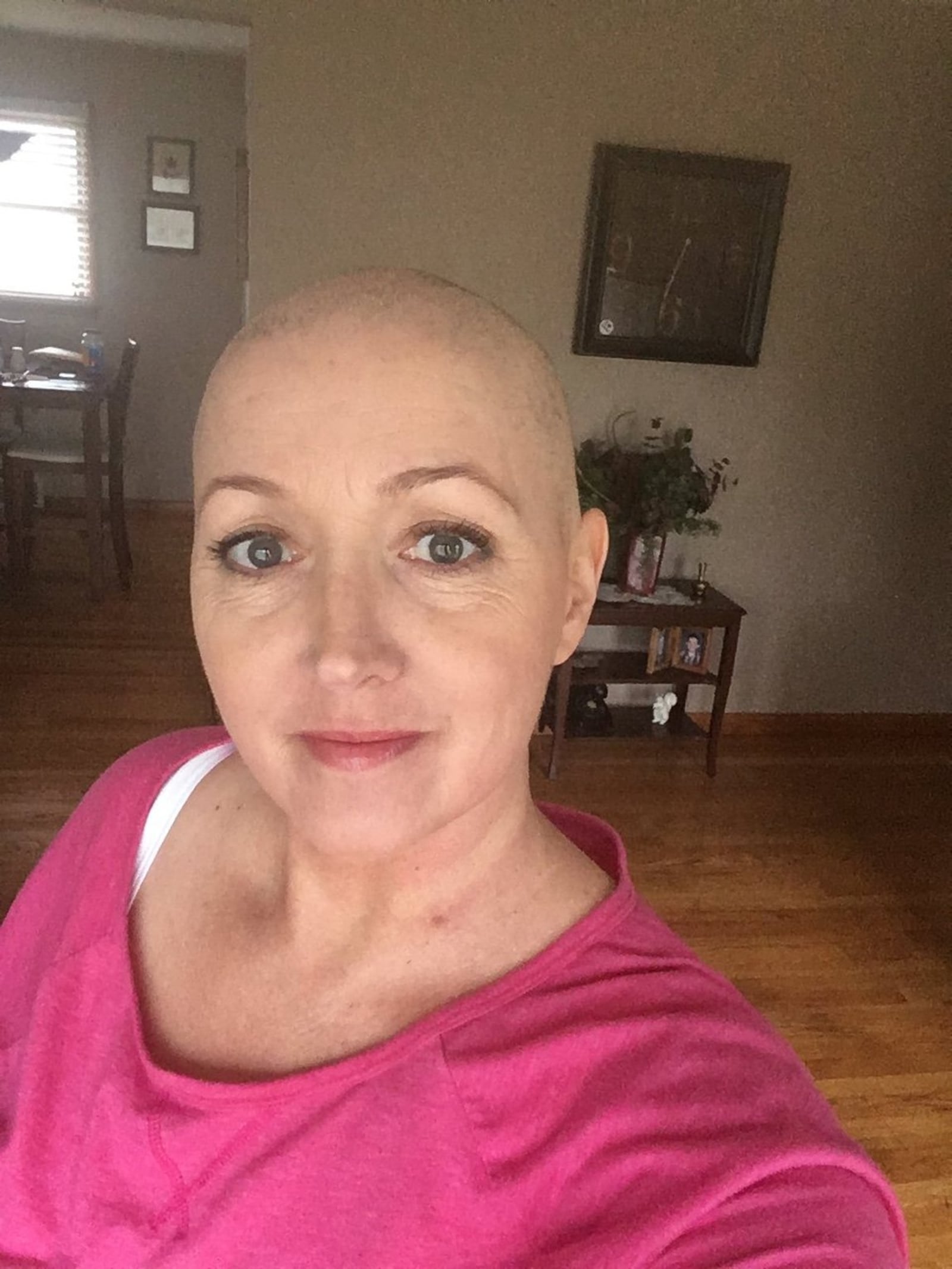 Dena Austin, 48, knew losing her hair would be part of her chemotherapy treatment for breast cancer. Her hair returned during radiation. SUBMITTED PHOTO