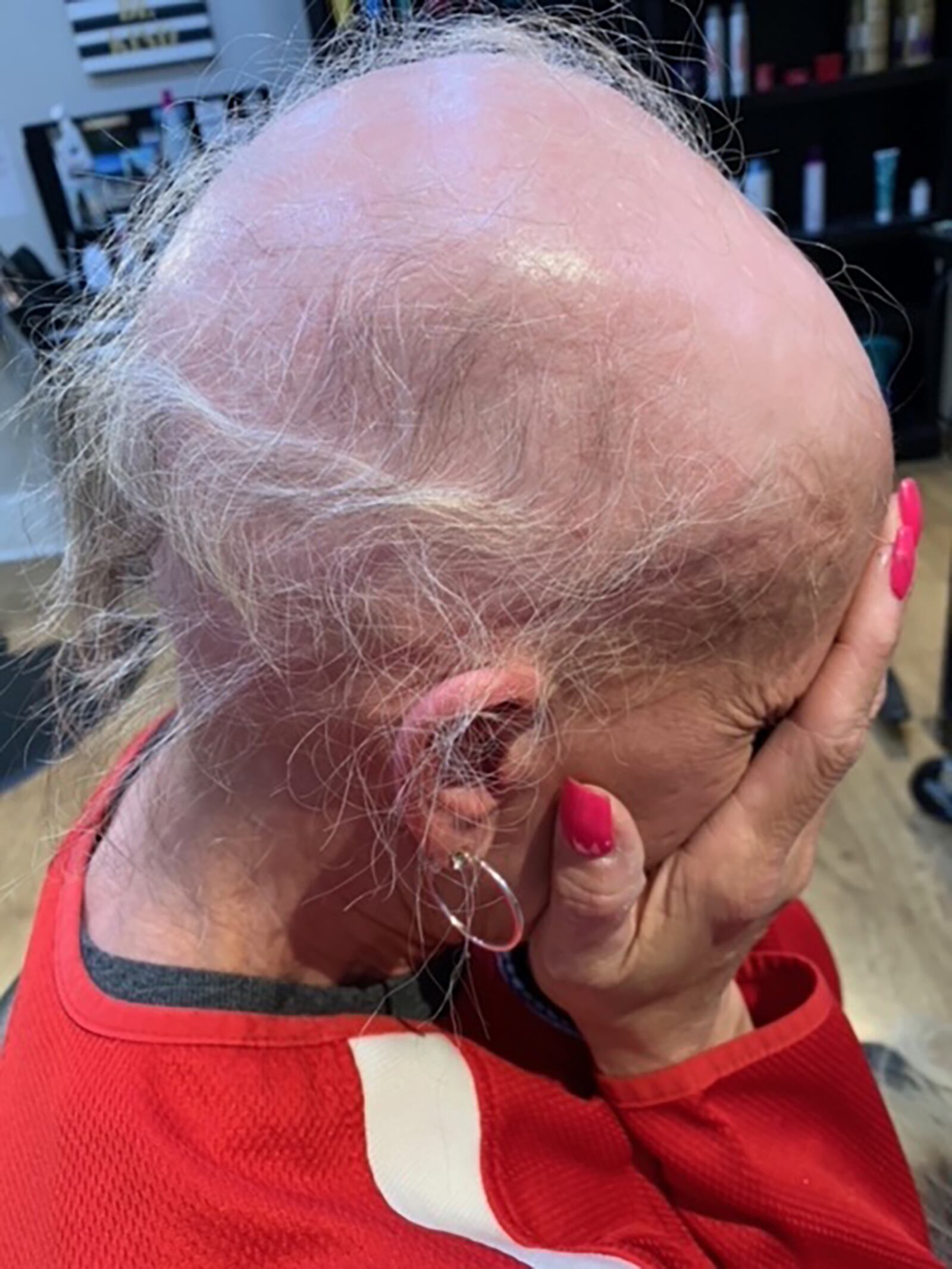 Carrie Kendall after losing most of her hair in 2021 due to black mold exposure. She shaved the remaining hair off after this picture was taken.