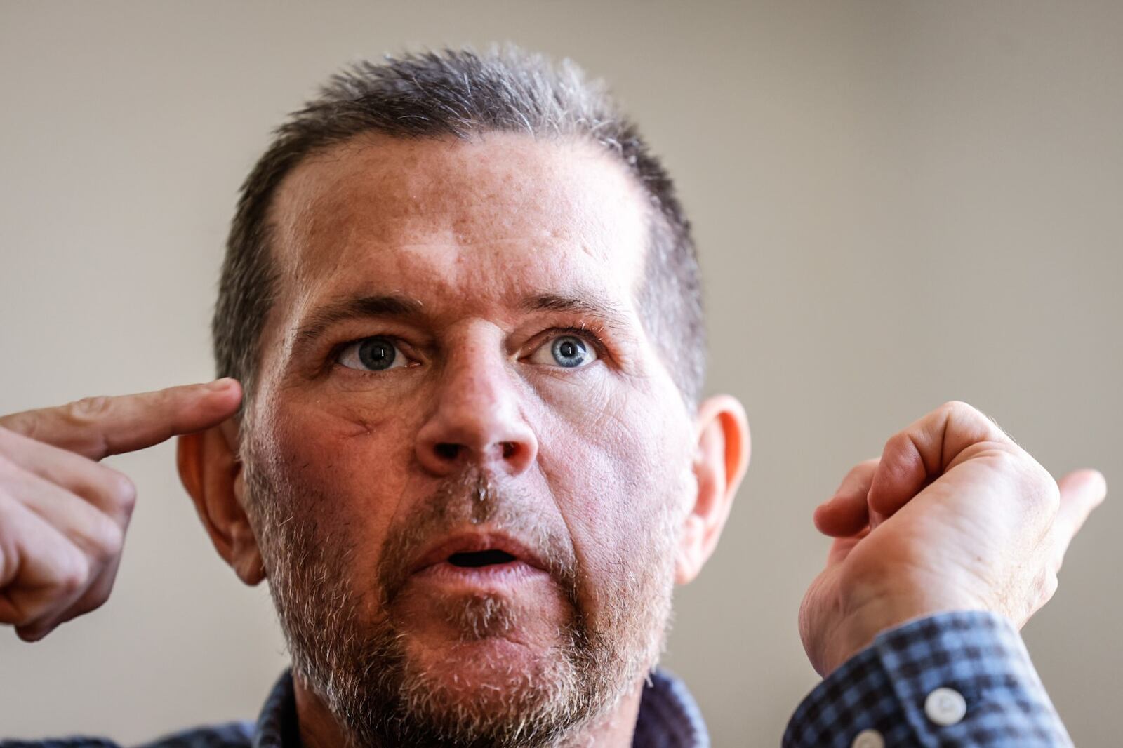 Clearcreek Township police officer, Eric Ney talks to the Dayton Daily News about being shot across the face in the line of duty in mid-July. JIM NOELKER/STAFF